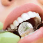 Ультразвуковая чистка зубов: основные преимущества метода